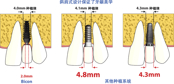 BiconNֲmЩ