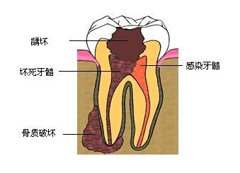 財(yng)עЩ?