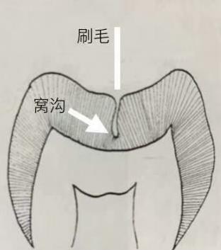 XCʾD